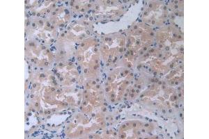 IHC-P analysis of kidney tissue, with DAB staining. (COL4a5 anticorps  (AA 1461-1685))
