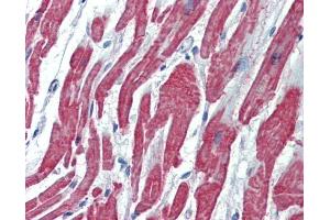 IHC-P Image Immunohistochemical analysis of paraffin-embedded human heart, using Activin A Receptor Type II-like 1, antibody(20 μg/ml).