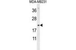 Western blot analysis in MDA-MB231 cell line lysates (35ug/lane) using DMRTC1 Antibody (N-term). (DMRTC1 anticorps  (N-Term))