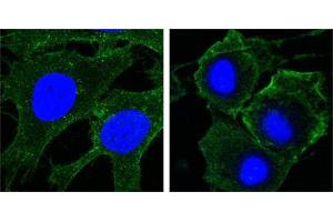 Confocal immunofluorescence analysis of Hela (left) and HepG2 (right) cells using KDR mouse mAb (green). (VEGFR2/CD309 anticorps  (AA 20-764))