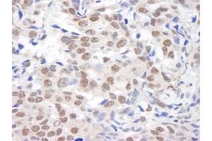 Immunohistochemistry (IHC) image for anti-Lysine (K)-Specific Demethylase 1A (KDM1A) (C-Term) antibody (ABIN7449396)