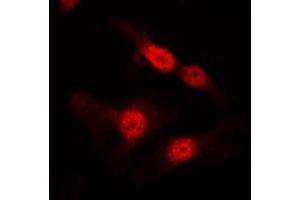 Immunofluorescent analysis of DGK alpha staining in MDCK cells.