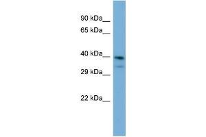 Host:  Rabbit  Target Name:  INPP5J  Sample Type:  Jurkat Whole Cell lysates  Antibody Dilution:  1. (INPP5J anticorps  (C-Term))