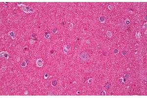 Anti-MAPT / Tau antibody IHC staining of human brain, cortex neuropil.