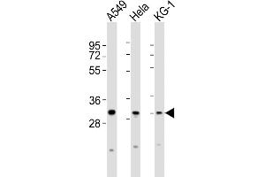 All lanes : Anti-PYCRL Antibody (C-term) at 1:2000 dilution Lane 1: A549 whole cell lysates Lane 2: Hela whole cell lysates Lane 3: KG-1 whole cell lysates Lysates/proteins at 20 μg per lane.
