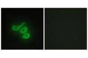 Immunofluorescence analysis of HepG2 cells, using M-CK antibody. (CKM anticorps  (N-Term))