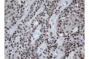 Image no. 1 for anti-Chromobox Homolog 8 (CBX8) (AA 1-260) antibody (ABIN1490663)