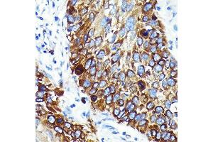 anti-Cathepsin B (CTSB) antibody