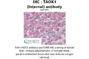 Image no. 2 for anti-TAO Kinase 1 (TAOK1) (Internal Region) antibody (ABIN1739900) (TAO Kinase 1 (TAOK1) (Internal Region) anticorps)