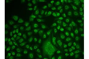 Immunofluorescence analysis of U2OS cell using TFPT antibody. (TFPT anticorps)