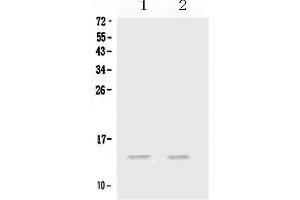 Western blot analysis of MIP-3 Alpha/CCL20 using anti-MIP-3 Alpha/CCL20 antibody . (CCL20 anticorps  (AA 28-97))