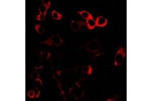 Immunofluorescent analysis of GLUR3 staining in U2OS cells.