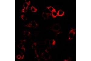 Immunofluorescent analysis of GLUR3 staining in U2OS cells. (Glutamate Receptor 3 anticorps)