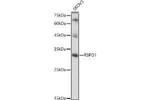 Western blot analysis of extracts of SKOV3 cells, using RSPO1 antibody (ABIN6132958, ABIN6147279, ABIN6147280 and ABIN6224304) at 1:1000 dilution. (RSPO1 anticorps  (AA 21-263))