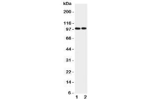 Western blot testing of EPB41L1 antibody and Lane 1:  rat brain (EPB41L1 anticorps  (C-Term))