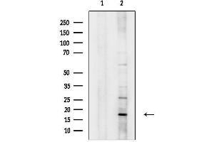 Western blot analysis of lysates from Rat heart, using ECRG4 Antibody.