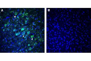 Expression of NEGR1 in rat parietal cortex Immunohistochemical staining of perfusion-fixed frozen rat brain sections with Anti-NEGR1 (extracellular) Antibody (ABIN7581917), (1:300), followed by goat anti-rabbit-AlexaFluor-488. (NEGR1 anticorps  (Extracellular))