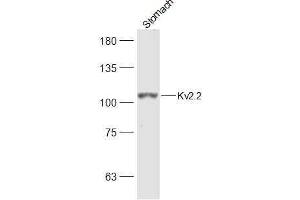 Rat Stomach lysates probed with Kv2. (Kv2.2 anticorps  (AA 21-120))