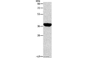 Western blot analysis of Mouse liver tissue, using ALDOB Polyclonal Antibody at dilution of 1:200 (ALDOB anticorps)