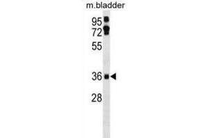 Western Blotting (WB) image for anti-Etoposide Induced 2.4 (EI24) antibody (ABIN3000878) (EI24 anticorps)