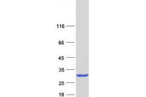 Validation with Western Blot