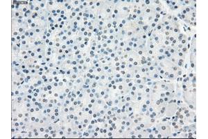 Immunohistochemical staining of paraffin-embedded Kidney tissue using anti-PPP5Cmouse monoclonal antibody. (PP5 anticorps)