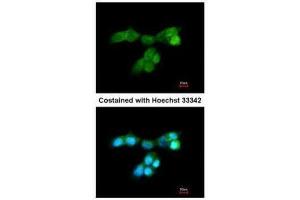 ICC/IF Image Immunofluorescence analysis of paraformaldehyde-fixed A431, using DUSP10, antibody at 1:200 dilution. (DUSP10 anticorps  (C-Term))