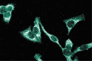Immunofluorescence staining of HeLa cells (Human cervical epitheloid carcinoma, ATCC CCL-2.