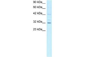 WB Suggested Anti-CCNH Antibody Titration:  1ug/ml  Positive Control:  Jurkat cell lysate CCNH is supported by BioGPS gene expression data to be expressed in Jurkat (Cyclin H anticorps  (C-Term))