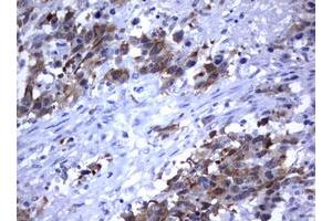 Image no. 4 for anti-Mdm2, p53 E3 Ubiquitin Protein Ligase Homolog (Mouse) (MDM2) (AA 119-438) antibody (ABIN1490872)