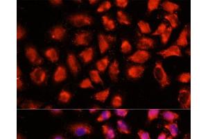 Immunofluorescence analysis of HeLa cells using ADAM8 Polyclonal Antibody at dilution of 1:100 (40x lens). (ADAM8 anticorps)