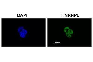 Immunofluorescent staining of MCF-7 cell with HNRNPL polyclonal antibody  at 1:200 dilution. (HNRNPL anticorps  (AA 82-131))