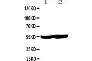 Western blot analysis of CYP2E1 using anti-CYP2E1 antibody .