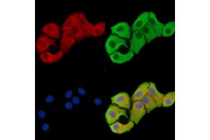 ABIN7096518 and ABIN7100582 staining Hela cells by IF/ICC. (OSBPL11 anticorps)