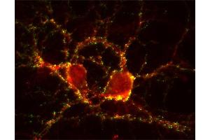 Immunocytochemistry (ICC) image for anti-SynCAM 1/2/3 (AA 436-446) antibody (ABIN1742491) (SynCAM 1/2/3 (AA 436-446) anticorps)