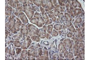 Image no. 1 for anti-Mitogen-Activated Protein Kinase Kinase 3 (MAP2K3) antibody (ABIN1499403)