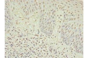 Immunohistochemistry of paraffin-embedded human tonsil tissue using ABIN7174944 at dilution of 1:100