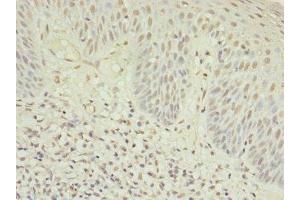 Immunohistochemistry of paraffin-embedded human tonsil tissue using ABIN7174944 at dilution of 1:100 (Myosin IC anticorps  (AA 804-1063))