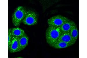 HepG2 cells were stained with Alas1 (1G11) Monoclonal Antibody  at 1:200 in PBS and incubated for overnight at 4C, followed by secondary antibody incubation, DAPI staining of the nuclei and detection