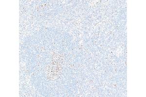 anti-Enhancer of Zeste Homolog 2 (EZH2) (AA 1-154) antibody