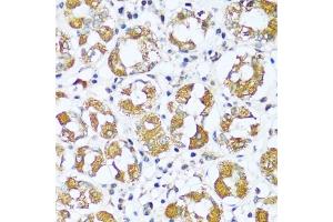 Immunohistochemistry of paraffin-embedded human stomach using I antibody (ABIN7265720) at dilution of 1:100 (40x lens). (ATP5I anticorps  (AA 1-69))