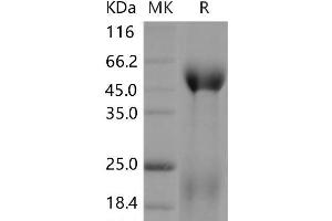 Western Blotting (WB) image for Contactin 5 (CNTN5) (Active) protein (His tag) (ABIN7320050)