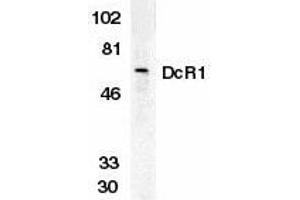 Western blot analysis of DcR1 in HeLa whole cell lysate with DcR1 antibody at 1 g/ml. (DcR1 anticorps)