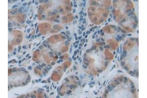 IHC-P analysis of Human Stomach Tissue, with DAB staining. (MYD88 anticorps  (AA 32-265))