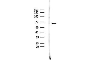 Western blot analysis of lysates from  cells(starvation,24h treatment), using NR4 Antibody at 1/1000 dilution.