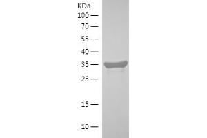 Western Blotting (WB) image for RAB1B, Member RAS Oncogene Family (RAB1B) (AA 59-199) protein (His-IF2DI Tag) (ABIN7124740)
