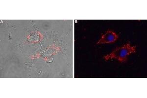 Expression of CaVγ5 (CACNG5) in living rat PC12 cells - Cell surface detection of CaVγ5 (CACNG5) in intact living rat PC12 cells using Anti-CACNG5 (extracellular) Antibody (ABIN7042993, ABIN7044061 and ABIN7044062), (1:25) followed by goat anti-rabbit-AlexaFluor-594 secondary antibody. (CACNG5 anticorps  (1st Extracellular Loop))