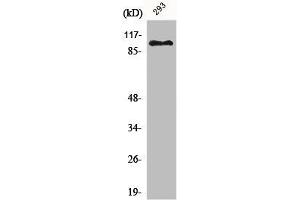 Western Blot analysis of 293 cells using ERCC4 Polyclonal Antibody (ERCC4 anticorps  (C-Term))