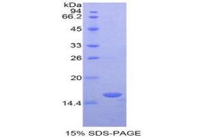 SDS-PAGE (SDS) image for Retinol Binding Protein 3, Interstitial (RBP3) (AA 1027-1229) protein (His tag) (ABIN1877801)
