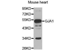 Western blot analysis of extracts of mouse heart, using GJA1 antibody. (Connexin 43/GJA1 anticorps  (AA 233-382))